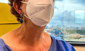 radiofrequency ablation